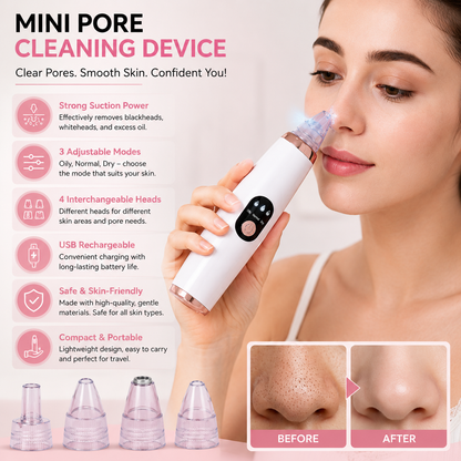 Deep Pore Vacuum Cleaner – Electric Blackhead & Pore Cleaning Device