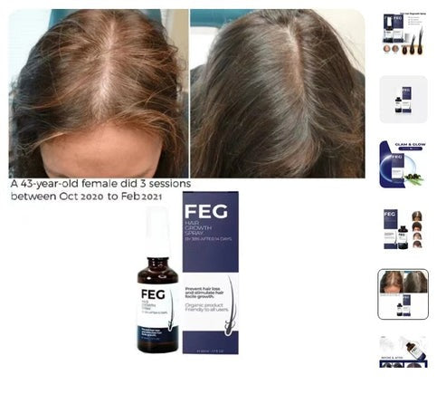 FEG Plus Minoxidil Beard & Hair Growth Serum